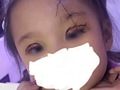 有人带小孩子整容?