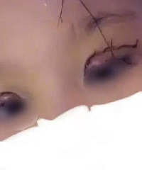 妈妈带着这么小的女儿去整容?