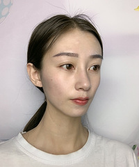 ��������˫��Ƥ�仯����������ͬ��˵��������