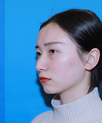 ���շ�ǡ�Ҳ�д��죬������get�ˡ��߼���������