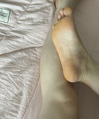 求问!脚底发黄是怎么回事哦