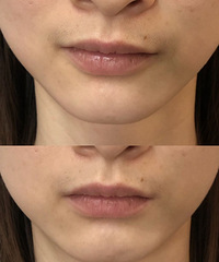 �����б���ֻ����Ϊ�����б���£�