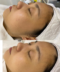 ��Ƥ����������󽱡�