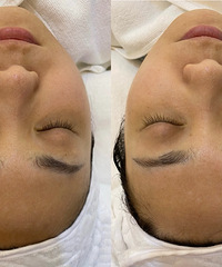 ��Ƥ����������󽱡�