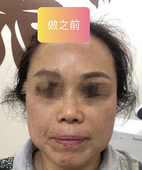 带妈妈做完欧洲之星她真的变美变年轻了
