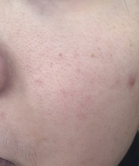 ë�״ִ���ʲôҽ����Ŀ�ܹ����ư���