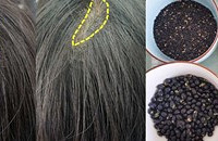 曾经差点秃顶的我,现在发量堪比赵露思
