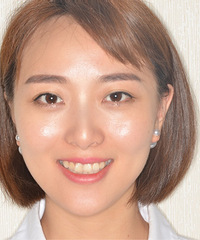 历时2年半终于矫正上岸,来总结一下我的漫长矫正路