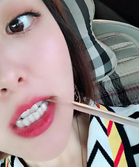 历时2年半终于矫正上岸,这一口大白牙太好看了