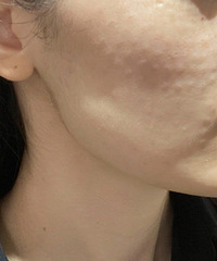 �����ˮ���������