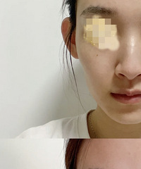 ����������沿�󣬿������ձ���������