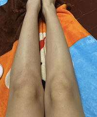 Ƥ���Ƴ��������о���