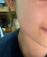 �Ҷ��˷�����Ƥ�����Խ��Խ��