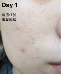 ���������������������������޸�Ƥ�������ǹؼ�