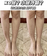 腿不直?XO型腿?小腿外翻?练好足踝才是根本!