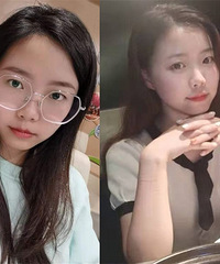 眼科工作20多年的张怡主任,告诉你如何5步完成全飞秒近视手术