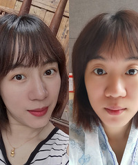 下定决心做了一个鼻整形,现在的鼻子很满意