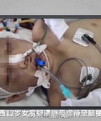 继母虐打女童致脑梗死被判无期,当庭表示要上诉
