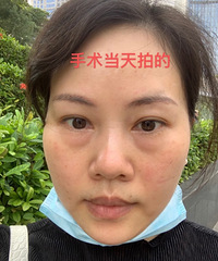 ���ö�����ҽ������Ҳ������ȥ�������۴�