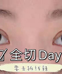 对我来说,双眼皮是一场豪赌。我,赌赢了