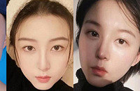 做了个“妈生款”鼻子,看着自然又精致