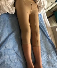 狗血!闺蜜抢男朋友,我含泪花了18000去瘦了大小腿