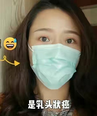 重庆美女31岁患癌,她将经历拍成视频