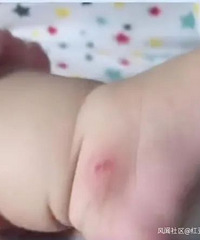 大妈抠掉女婴脚皮,警方通报