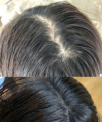 2小时“长”出发际线和头顶发缝,不痛没有尴尬期