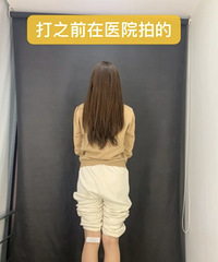 瘦腿针三个月真实记录分享!小腿真的变细了