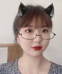 晒一晒我新做的双眼皮,内双→大双眼皮绝绝子!