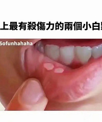 总是反复发作的口腔溃疡,这些方法可以让它恢复更快