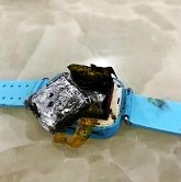 ��ͯ�绰�ֱ�ͻȻ��ȼ