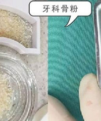 成都种植牙医院哪家好?成都贝臣种植牙,种植牙为什么为用到骨粉