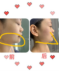 ����Dehoor淺��沿V��