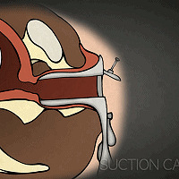 �������ʹ����������