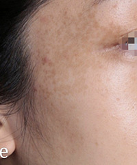 �����ϴ�����Ƥ���Ѿ�3�����ˣ������ҵľ���