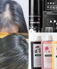 亲测有效的生发干货,脱发的快点来看