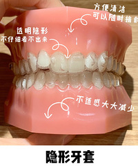 成都贝臣口腔医院牙齿矫正怎么样?贝臣口腔看牙联系方式。