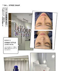 *FANFAN*纯素颜反馈dehoor臻美变脸