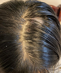 ͷͣÿ춼Ҫϴͷûʲô͵ϴˮƼ