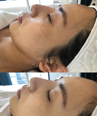 几个月没去做皮肤管理皮肤居然这么暗了立马来了个“追光者”