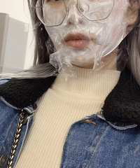 做完点阵激光后,皮肤状态真的变好了