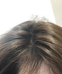 我用过的生发产品测评,脱发回春秘籍