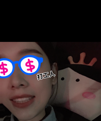 近两年的窟牙经历,隐形矫正真的美观很多