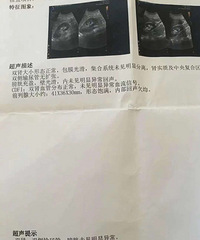 以为只有妇科病,原来男人也有男科病