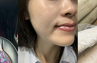 现在的美白方法真是花样百出,说说你是怎样变白的