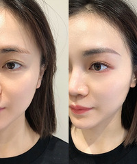 ��ü�ε���Ҫ��  ���ѡ��ü����С��һȦ