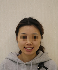 30�꿪���Ľ���֮�ã�ֻҪ����ʲôʱ�򶼲���̫��