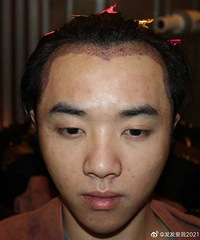 ����������������ǰ��ҽԺ�ĵ���Ƭ������˵�Ǻ��������